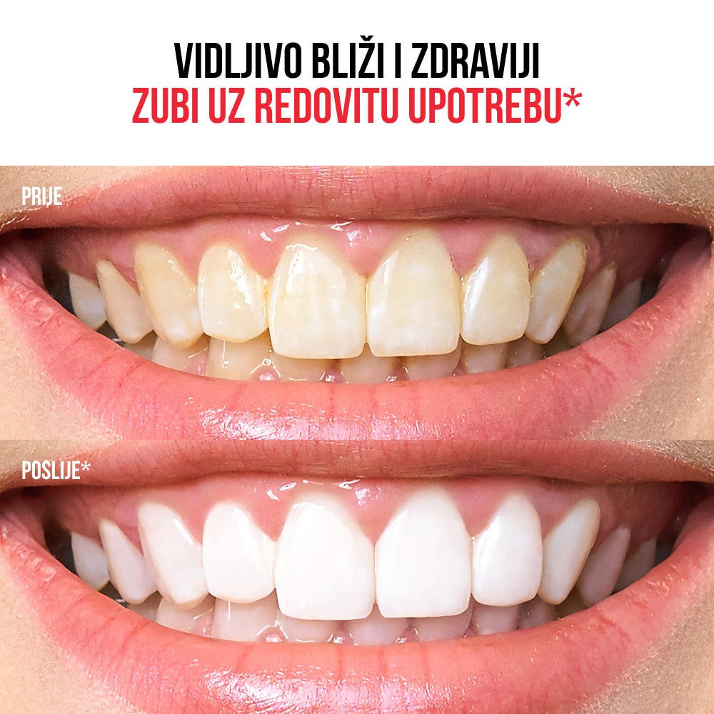 Regenerativna pasta za zube 6 u 1