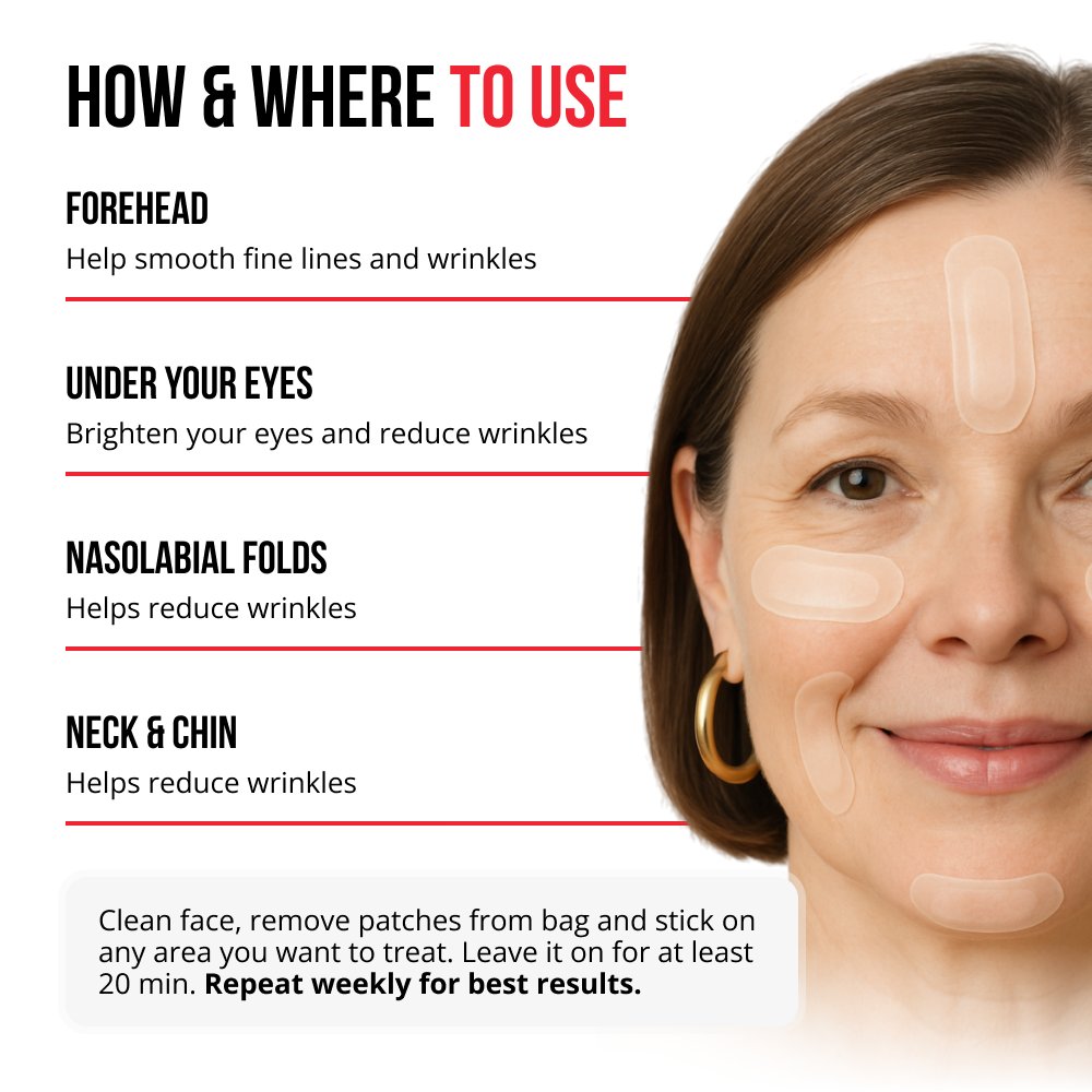 Samorazgrađujući mikroneedle flasteri