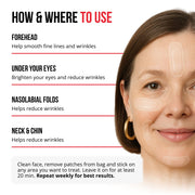 Samorazgrađujući mikroneedle flasteri